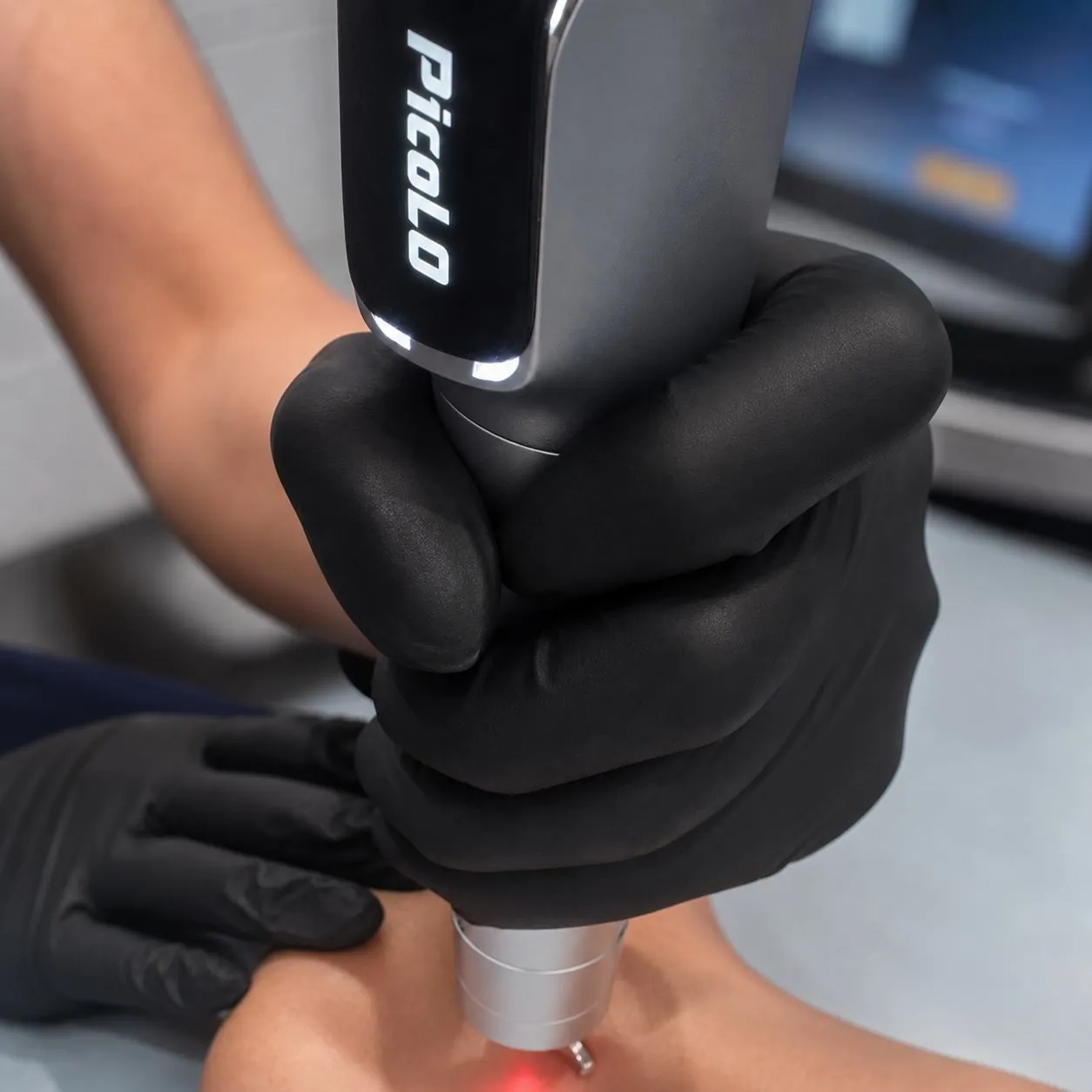 A Rejuvia laser tech performing a Motus AZ+ treatment