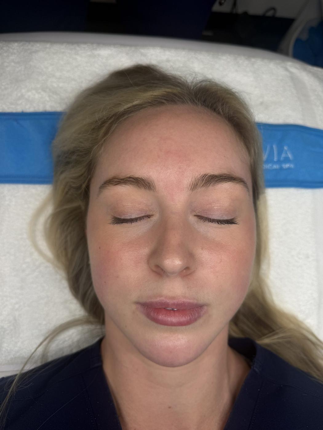 Smooth skin at Rejuvia
