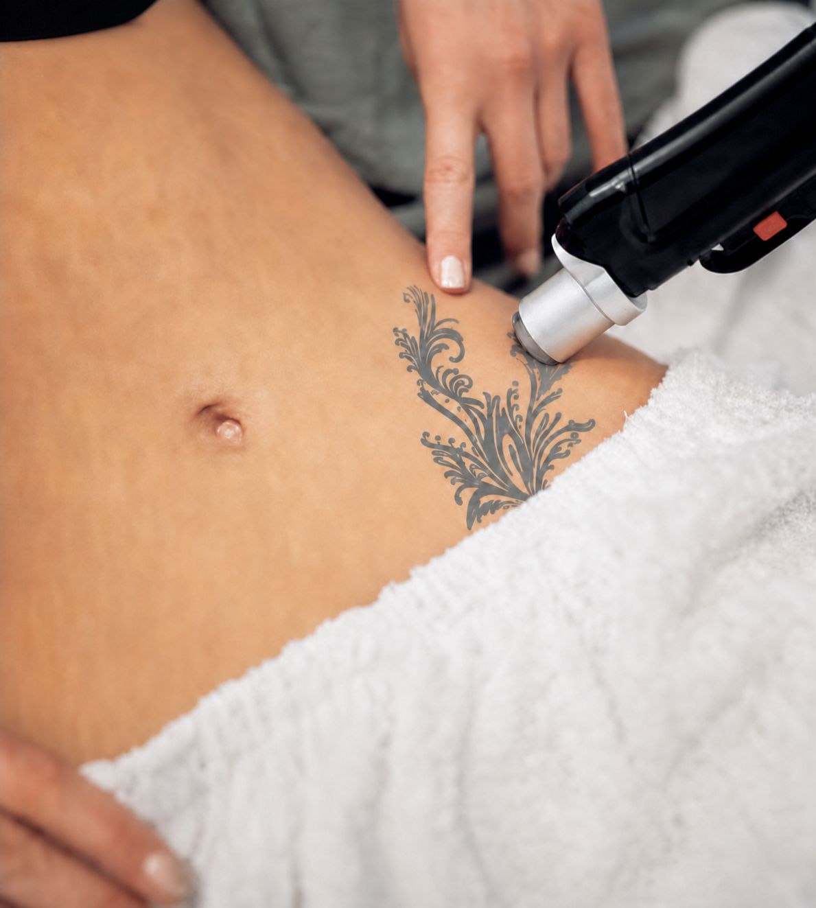 The PicoLO treating a tattoo at Rejuvia